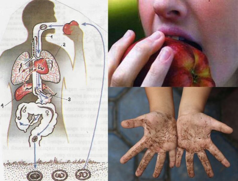 routes of infection by parasites