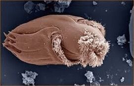 Pathogenic microorganisms in humans