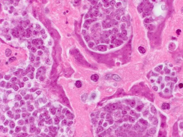 Search for parasites in a person