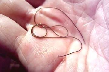 parasitic worm of the human body