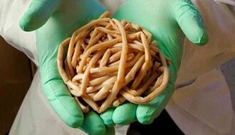 Methods of elimination of body parasites
